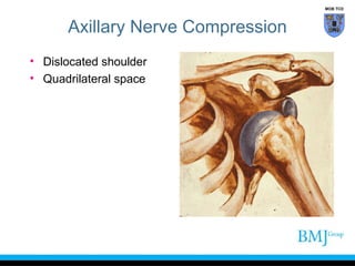 Axilla Compression Back Anatomy of nerve injuries upper limb | PPT