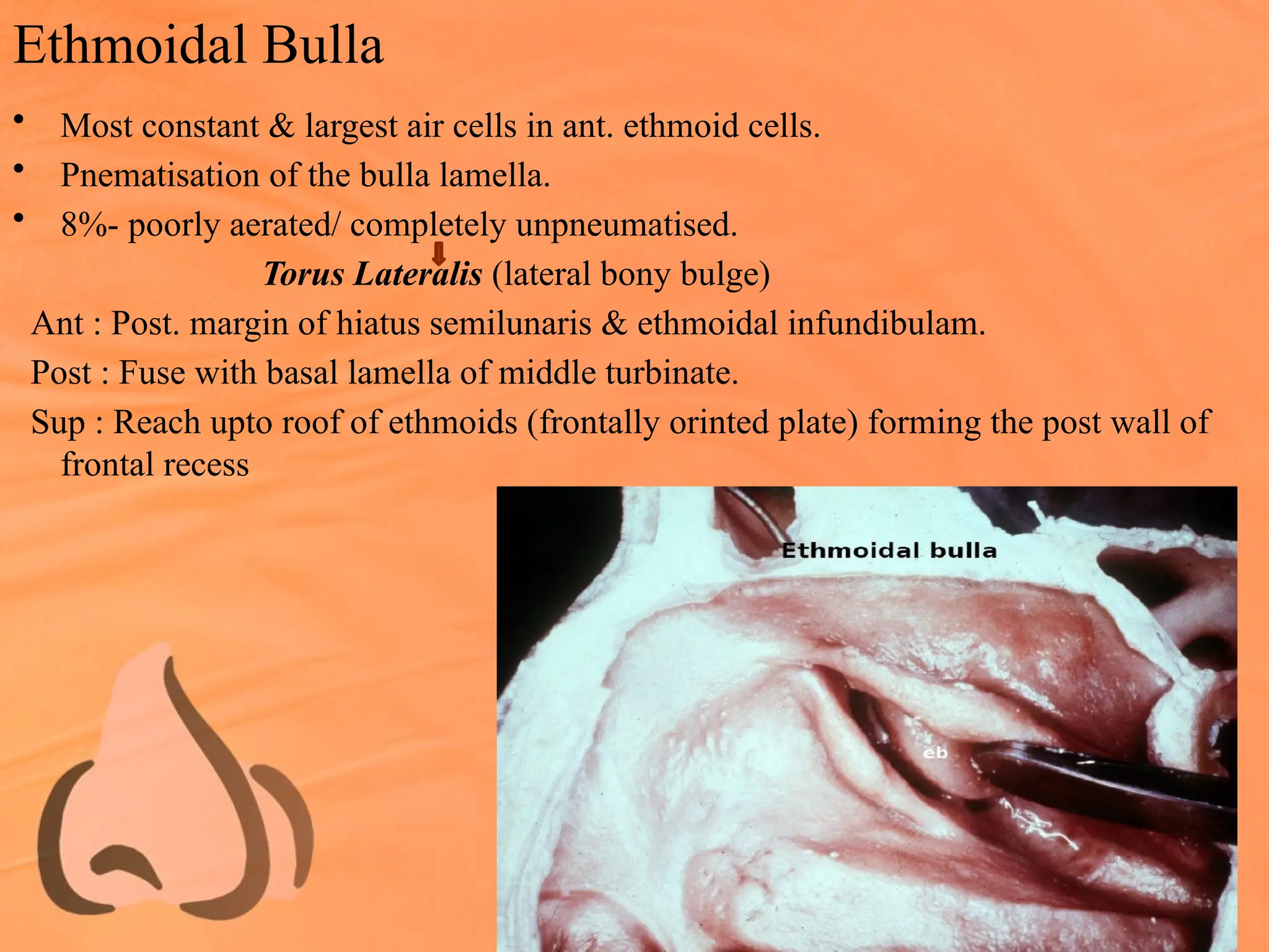 Ethmoidal Bulla
• Most constant & largest air cells in ant. ethmoid cells.
• Pnematisation of the bulla lamella.
• 8%- poorly aerated/ completely unpneumatised.
Torus Lateralis (lateral bony bulge)
Ant : Post. margin of hiatus semilunaris & ethmoidal infundibulam.
Post : Fuse with basal lamella of middle turbinate.
Sup : Reach upto roof of ethmoids (frontally orinted plate) forming the post wall of
frontal recess
 