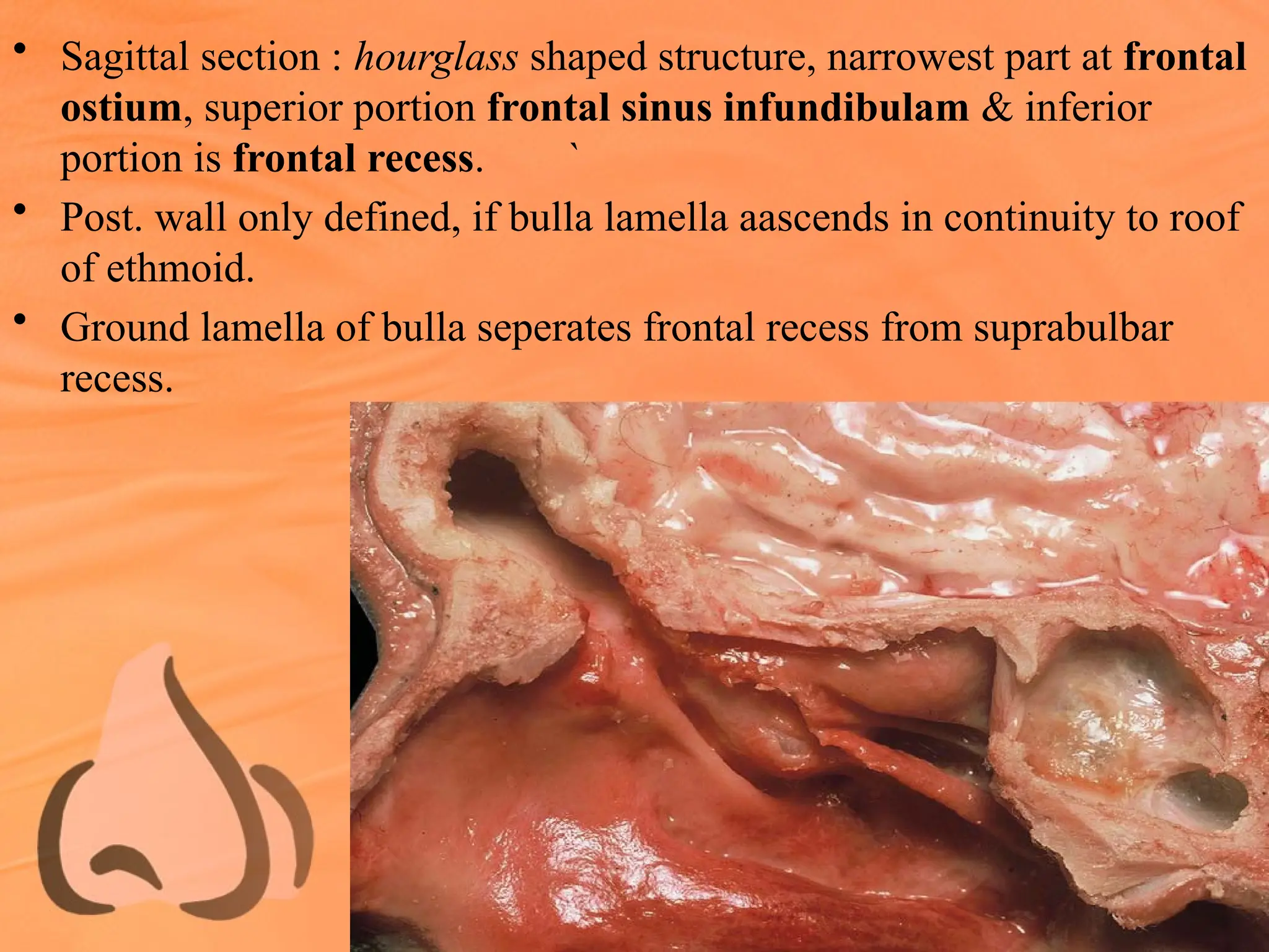 • Sagittal section : hourglass shaped structure, narrowest part at frontal
ostium, superior portion frontal sinus infundibulam & inferior
portion is frontal recess. `
• Post. wall only defined, if bulla lamella aascends in continuity to roof
of ethmoid.
• Ground lamella of bulla seperates frontal recess from suprabulbar
recess.
 