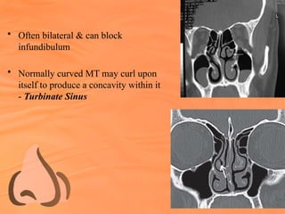 ANATOMY of NOSE power point presentation | PPTX
