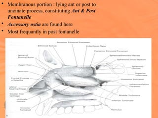 Accessory Ostium ANATOMY of NOSE power point presentation | PPTX
