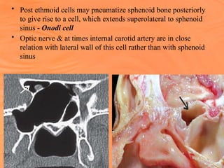 ANATOMY of NOSE power point presentation | PPTX