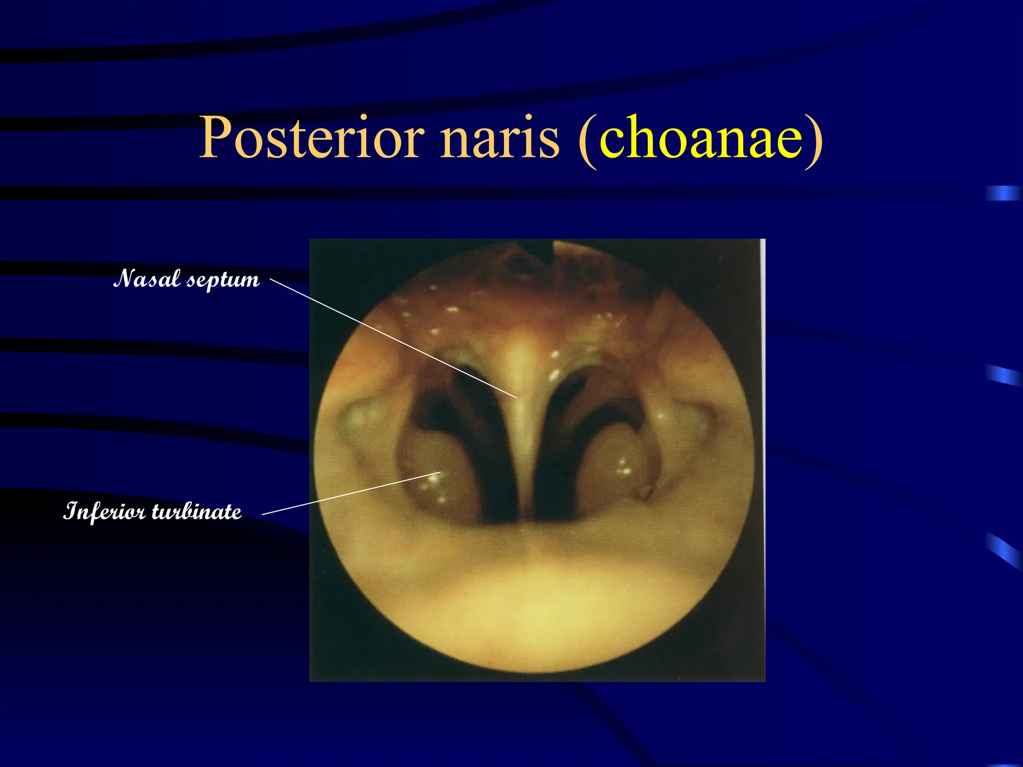 Anatomy of Nose by internal n external anatomy.pptx