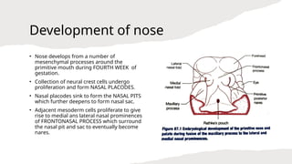 Anatomy of Nose and Paranasal sinuses.-Dr Vijay-Aiims kalyani.pptx