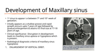 Anatomy of Nose and Paranasal sinuses.-Dr Vijay-Aiims kalyani.pptx