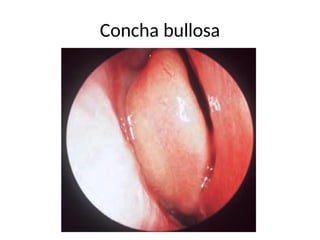 Comprehensive Anatomy and Development of Nose and Paranasal Sinuses | PPTX