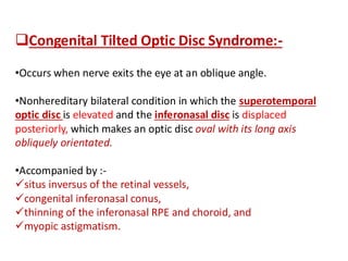 anatomy of optic nerve diagnosis and management | PDF