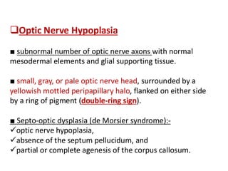 Subnormal Number anatomy of optic nerve diagnosis and management | PDF