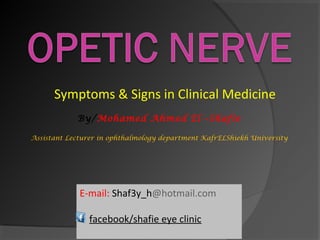 E-mail: Shaf3y_h@hotmail.com
facebook/shafie eye clinic
Symptoms & Signs in Clinical Medicine
By/Mohamed Ahmed El –Shafie
Assistant Lecturer in ophthalmology department KafrELShiekh University
 