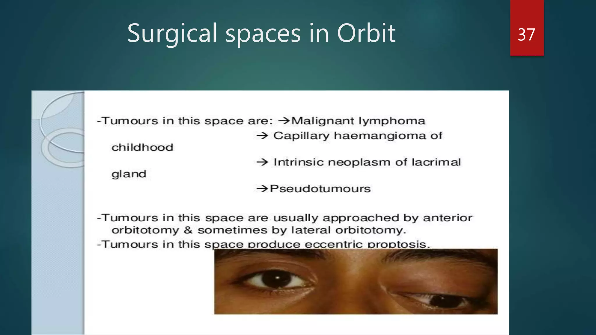 Surgical spaces in Orbit 37