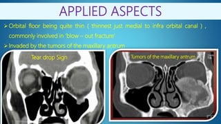 Anatomy of orbit by Dr.Prakash Bam | PPTX