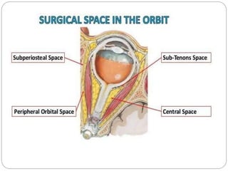 Anatomy of Orbit and its clinical importance | PPTX