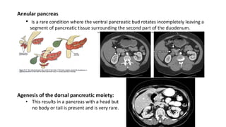 Radiological Anatomy of pancreas | PPTX