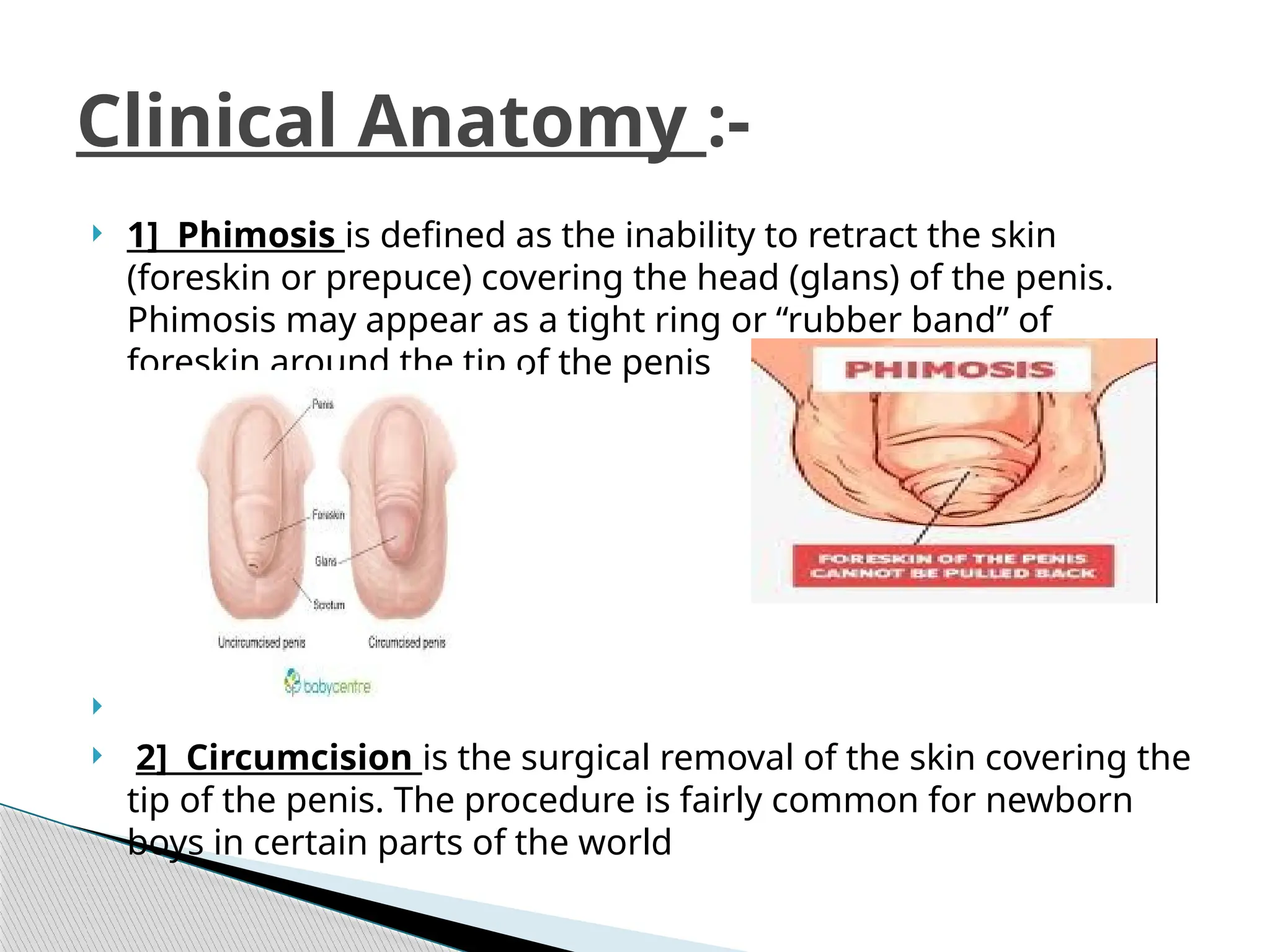 ANATOMY OF PENIS_1.pptxjgggn ytt. Ytfhi. Y | PPTX