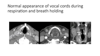 ANATOMY OF PHARYNX AND LARYNX.pptx