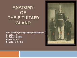 ANATOMY
OF
THE PITUITARY
GLAND
Who suffer (s) from pituitary disturbances?
1) Soldier # 1
2) Soldier # 2
3) Soldier # 3
4) Soldiers # 1 & 3
1
2
3
 