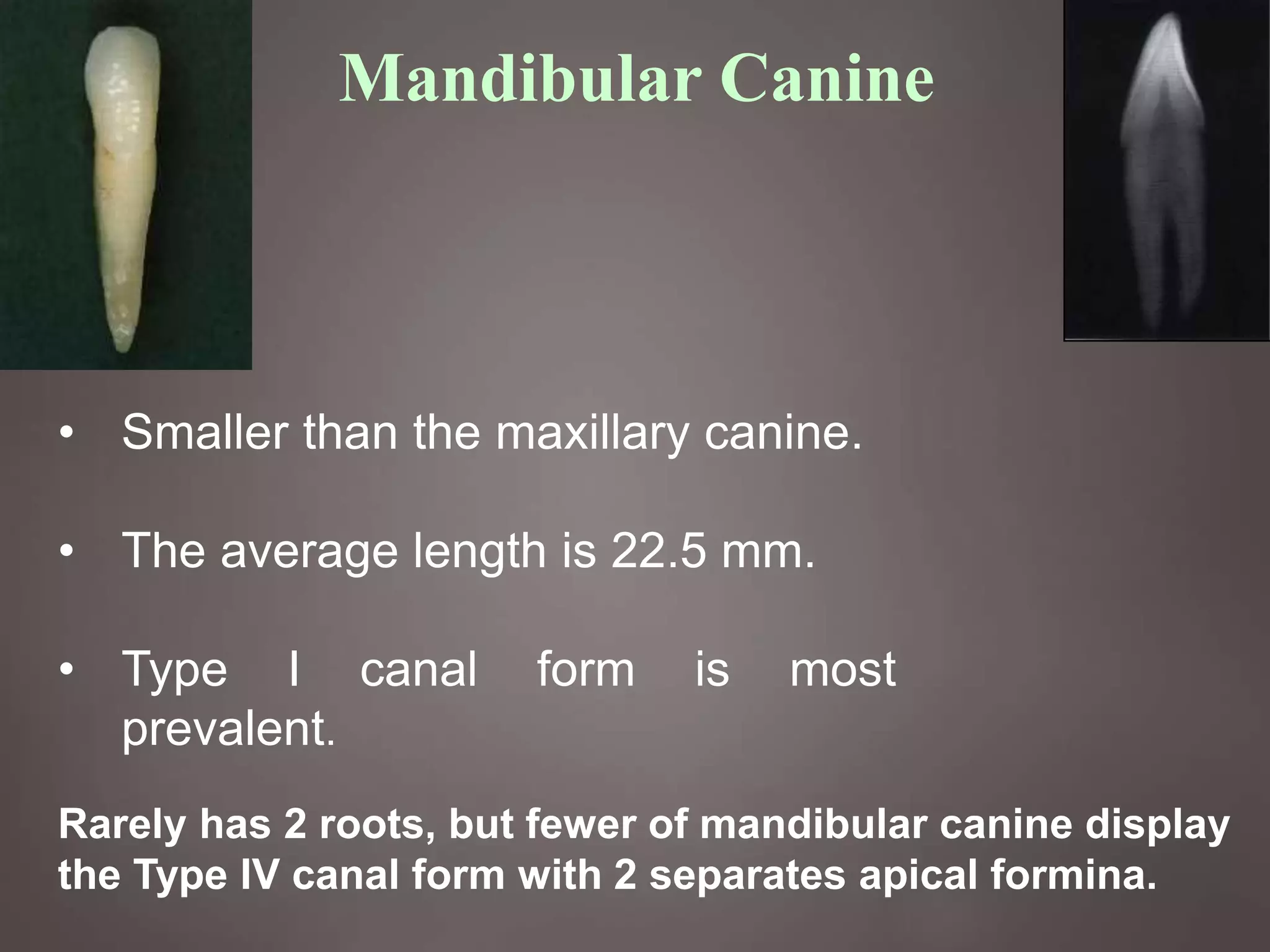 24
Mandibular Canine
• Smaller than the maxillary canine.
• The average length is 22.5 mm.
• Type I canal form is most
prevalent.
Rarely has 2 roots, but fewer of mandibular canine display
the Type IV canal form with 2 separates apical formina.
 