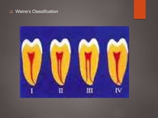  Weine’s Classification
 