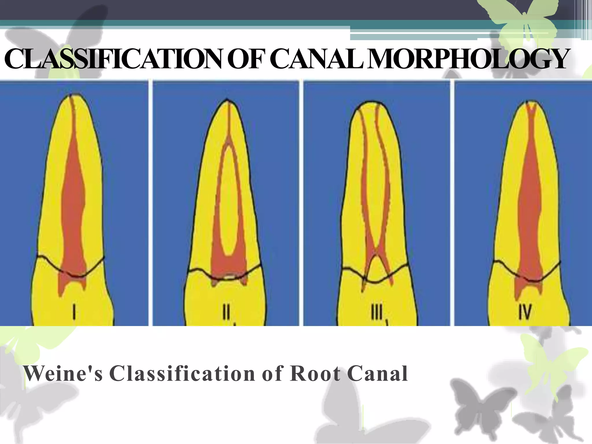 Weine Classification Anatomy of pulp canal and its access opening | PPTX