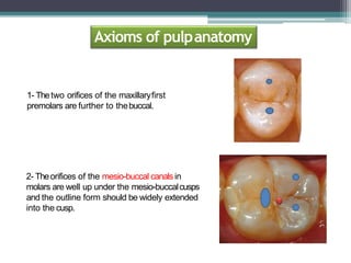 Anatomy of pulp canal and its access opening | PPTX
