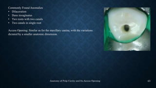 anatomy of pulp cavity and access opening.pptx
