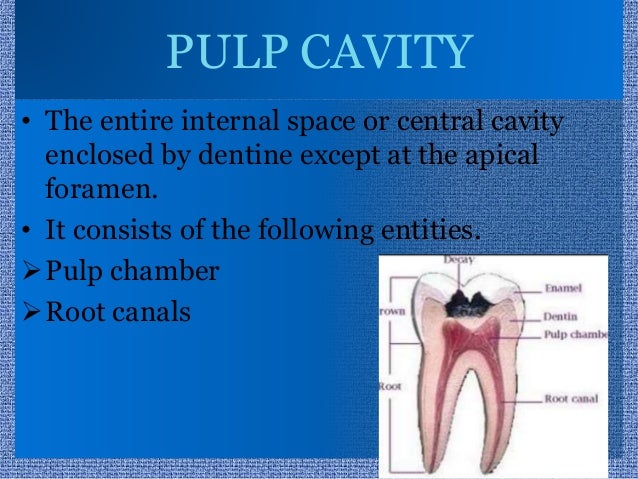 Anatomy of pulp cavity of maxillary teeth (2)