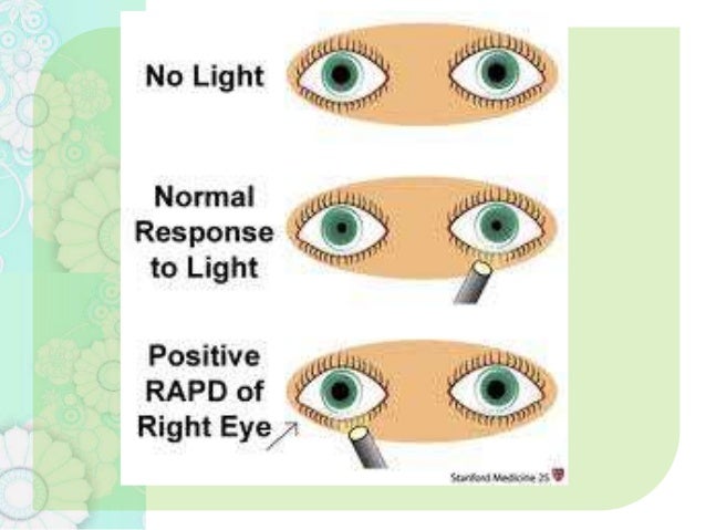 Anatomy of pupillary pathways