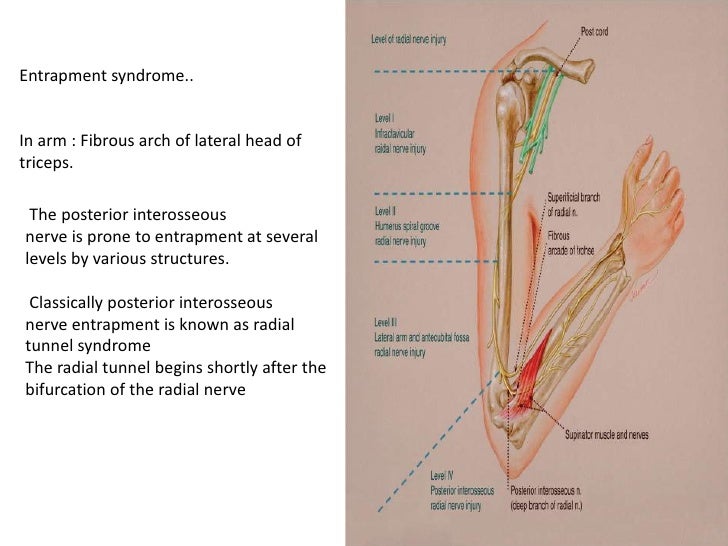 Anatomy of radial,median &ulnar nerve