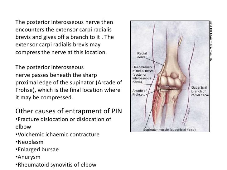 Anatomy of radial,median &ulnar nerve