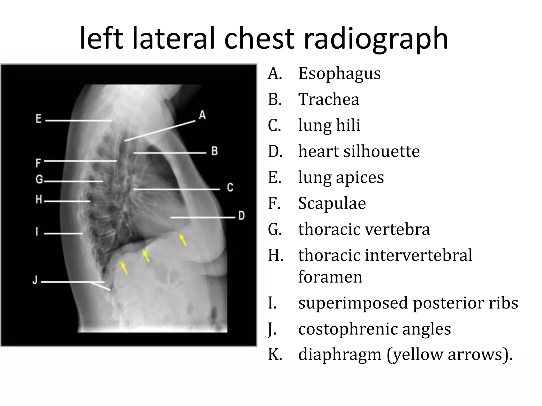 Respiratory System - Anatomy | PPSX