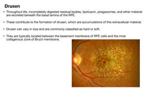 ANATOMY OF RETINA and not physiology of eyepdf | PDF