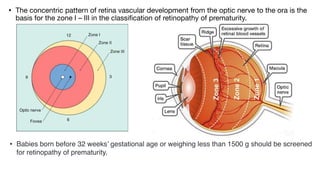 ANATOMY OF RETINA and not physiology of eyepdf | PDF