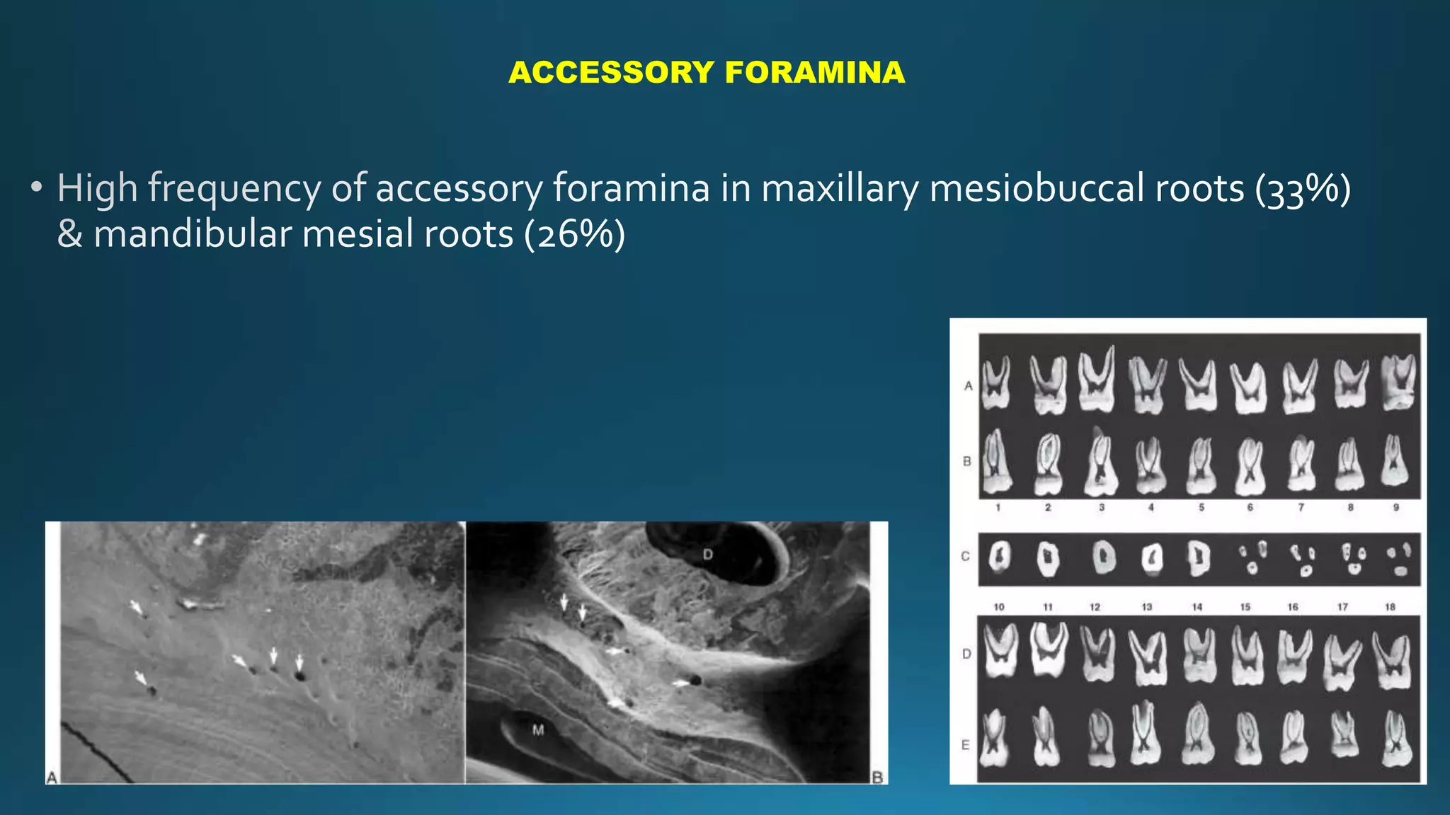 ACCESSORY FORAMINA
 