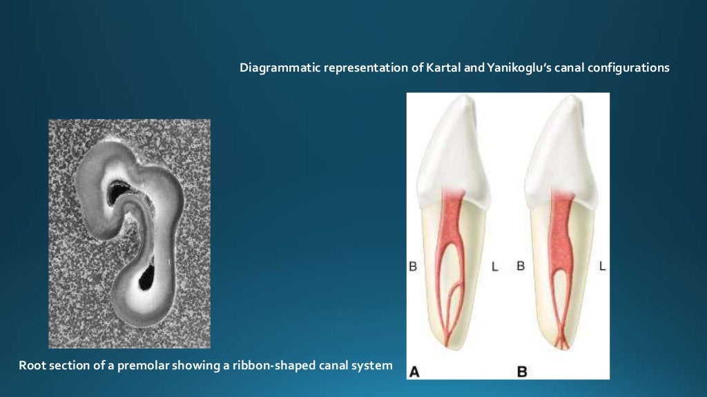 Anatomy of root apex and its significance new
