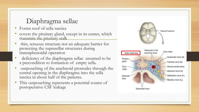 Anatomy of sellar suprasellar region