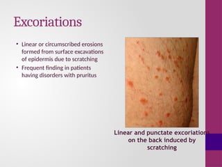 Excoratio Anatomy of skin and basic skin lesions.pptx