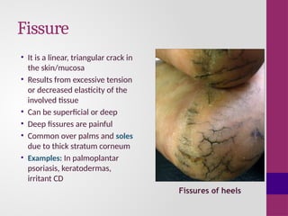 anatomy-of-skin-and-basic-skin-lesions-pptx