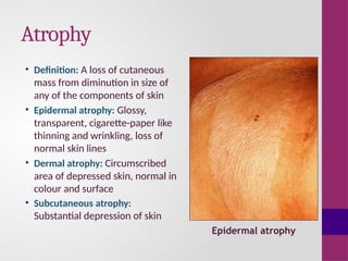 Anatomy of skin and basic skin lesions.pptx
