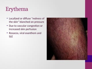 Anatomy of skin and basic skin lesions.pptx