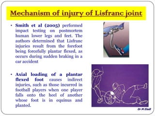 Dr M Eladl
Mechanism of injury of Lisfranc joint
• Smith et al (2005) performed
impact testing on postmortem
human lower legs and feet. The
authors determined that Lisfranc
injuries result from the forefoot
being forcefully plantar flexed, as
occurs during sudden braking in a
car accident
• Axial loading of a plantar
flexed foot causes indirect
injuries, such as those incurred in
football players when one player
falls onto the heel of another
whose foot is in equinus and
planted.
 