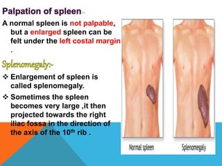 Spleen Inverted Anatomy of spleen | PPTX