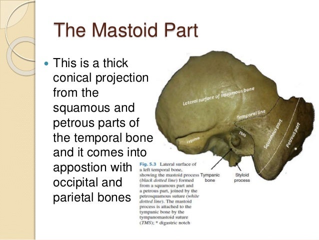 the projection of the temporal bone is the Anatomical description and frequencies of bony projections on the cerebral aspect of the petromastoid part of the temporal bone in dry adult human skulls. the projection of the temporal bone is the Anatomical description and frequencies of bony projections on the cerebral aspect of the petromastoid part of the temporal bone in dry adult human skulls.