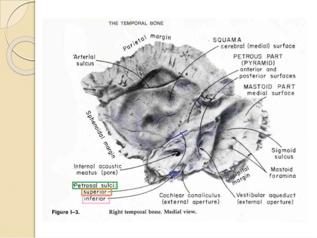 Anatomy of temporal bone By Dr.Vijay kumar , AMU