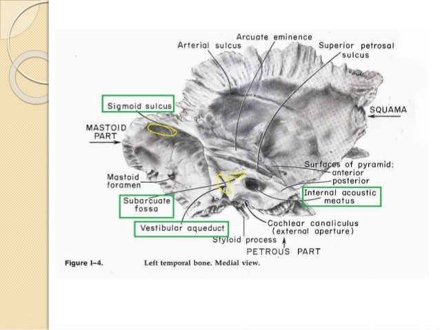 Anatomy of temporal bone By Dr.Vijay kumar , AMU