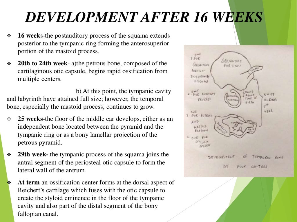Anatomy of temporal bone and it’s surgical importance