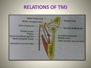 Tmj Relations anatomyoftemporomandibularjoint-210112114624.pdf