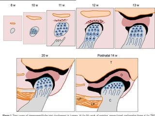 Tm Ray Anatomy of temporomandibular joint(tmj) | PPTX