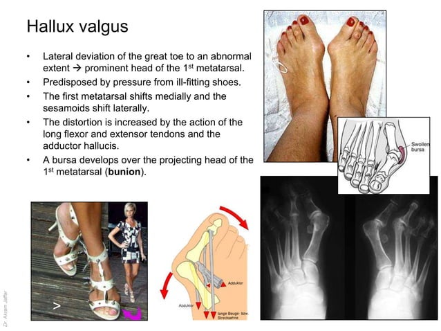 Anatomy of the ankle and joints of foot