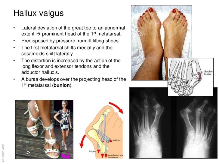 Anatomy of the ankle and joints of foot