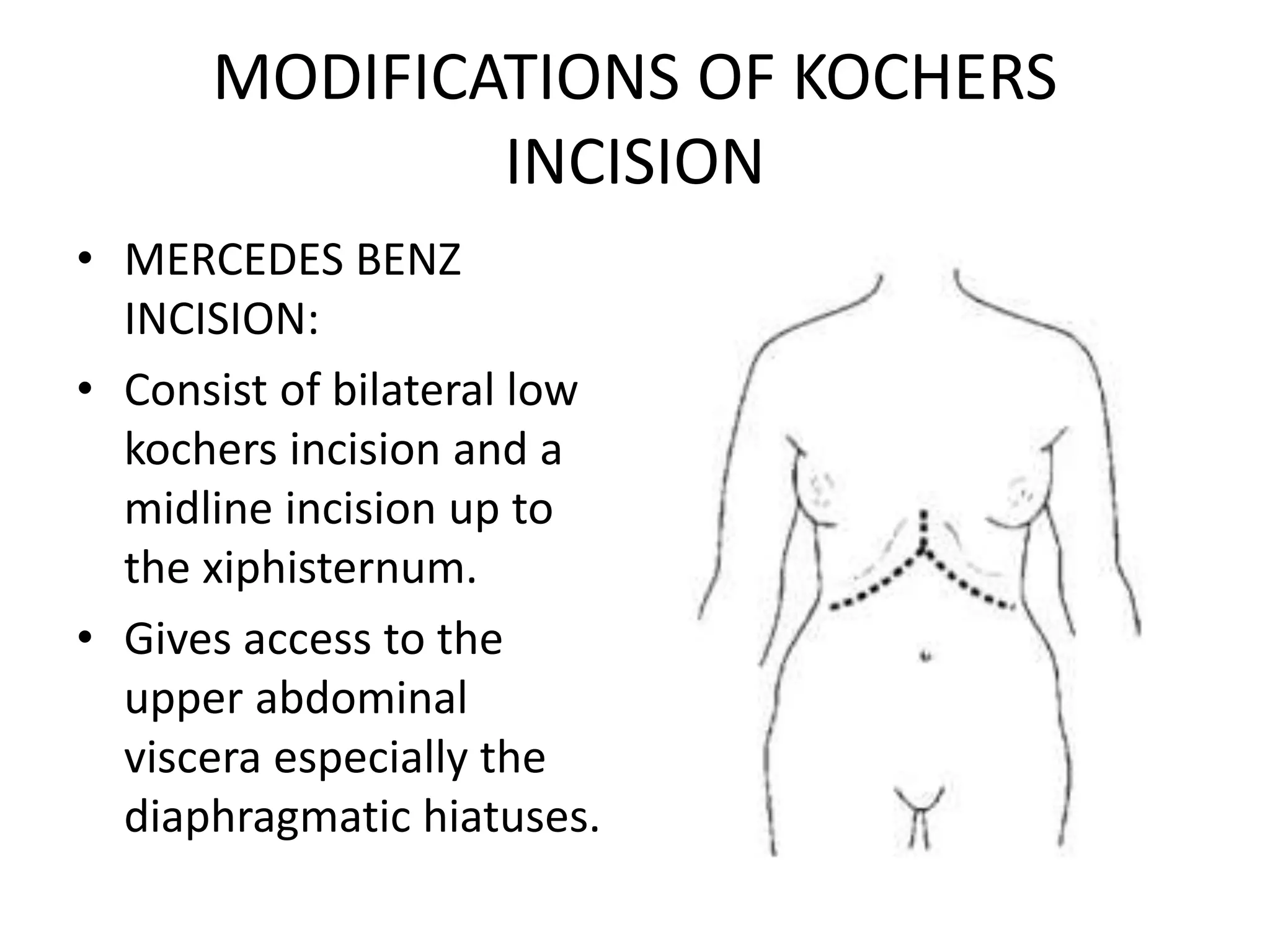 Anatomy of the anterior abdominal wall and incisions | PPTX